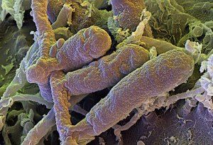 Ringworm Fungus