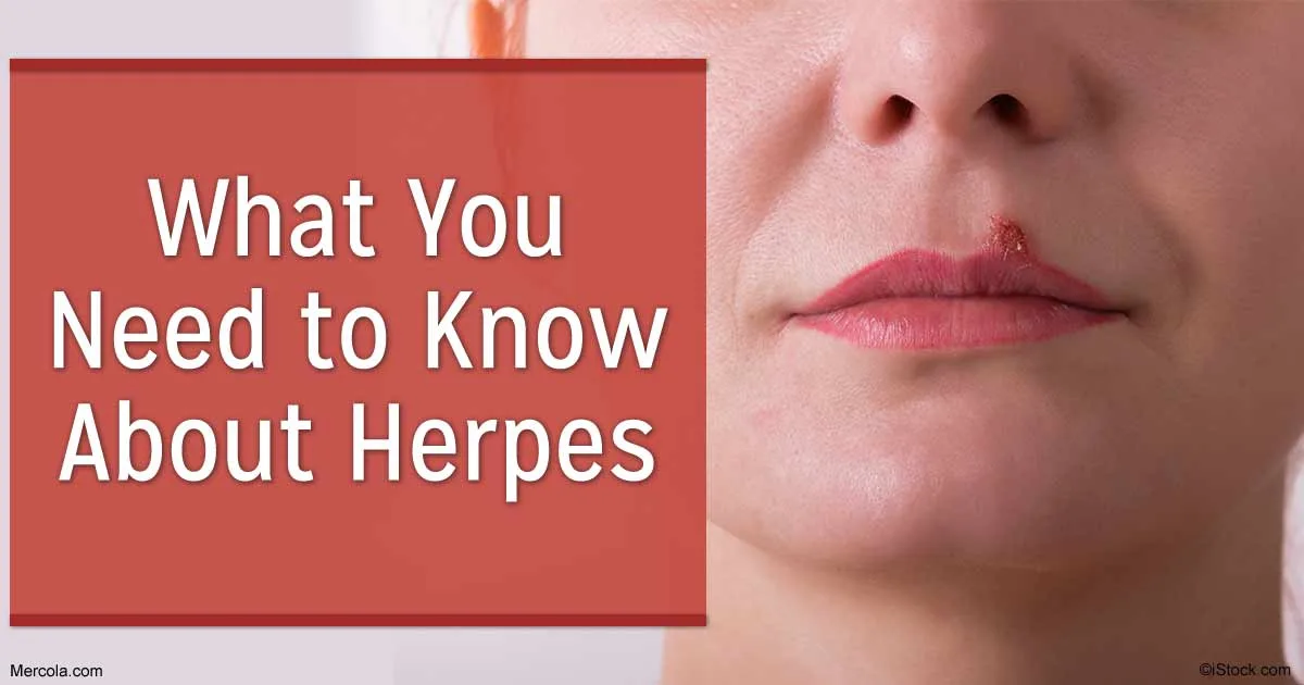 Vanguard said to be able to cure herpes; STD still plagues followers