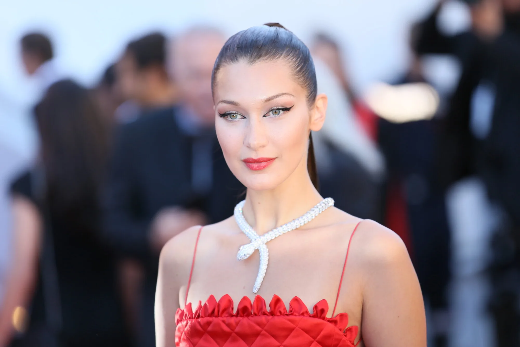 Bella Hadid Posts A Tearful Lyme Disease Update