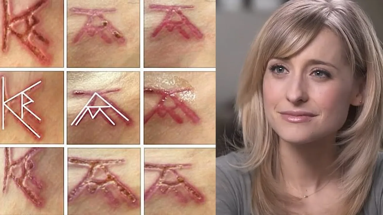 Shivani: Allison Mack’s Initials Unmistakable in Nxivm Slaves’ Pubic Brands