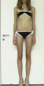 Ideal body weight.