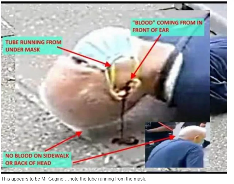 FBI Agent: Does Closeup Photo of Buffalo Protester Pushed by Police Suggest He May Have Faked the Whole Thing – Even the Blood?