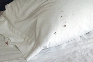Blood Stained Sheets Bed Bugs