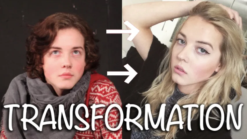 Guest View: Transgender who did not get timely hormone treatment explains pain of delay