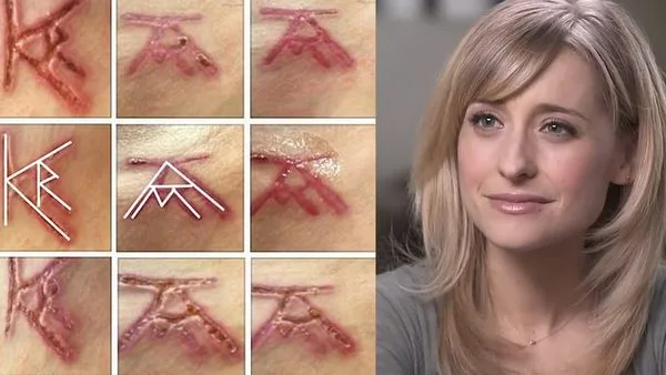 The debate continues as to whether or not Allison Mack's initials were included in the brand. While most say it was not, including Keith Raniere, it has been speculated that her initials are included and that Raniere did so in order to put the blame on her if she was caught. While there is no hard evidence of the latter, it is interesting that the AM can be seen right side p but in order to see the K -R one needs to see the brand turned 90 degrees counter clockwise.