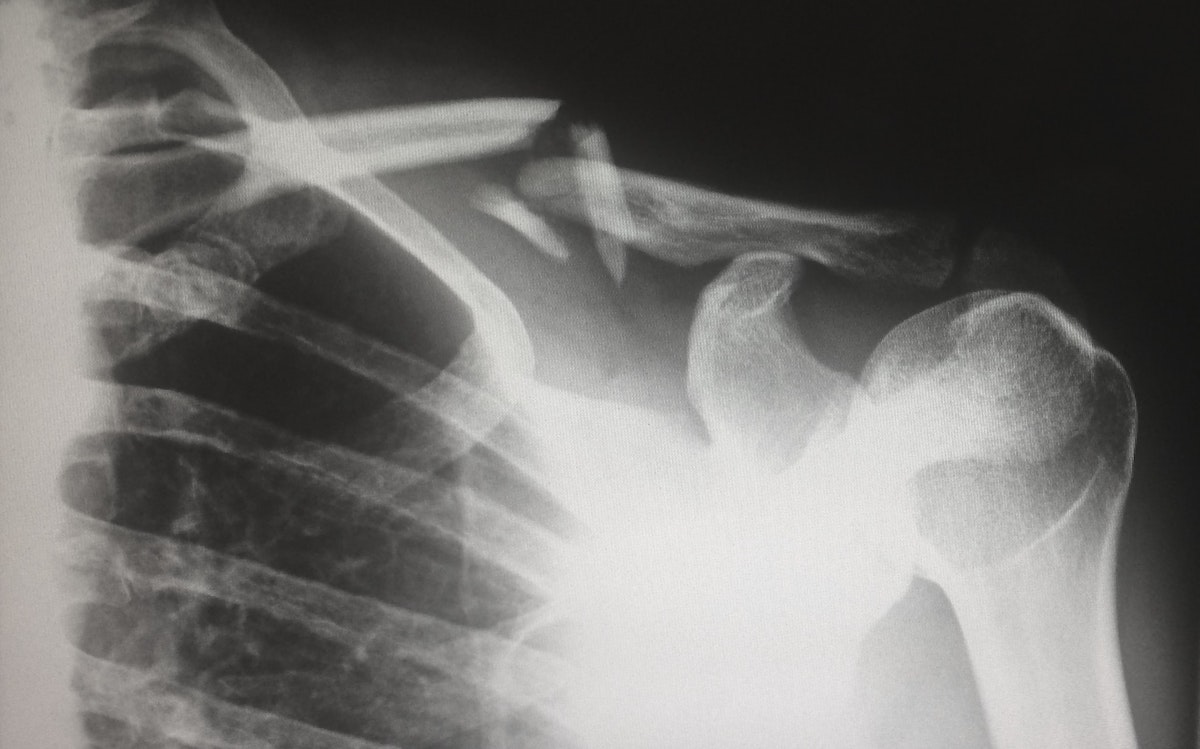 Useful Tips On How To Properly Deal With An Injury