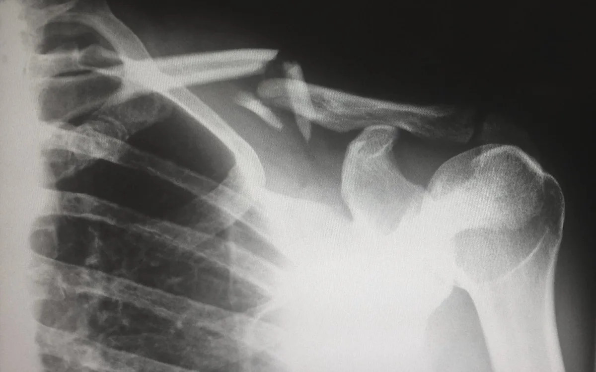 Useful Tips On How To Properly Deal With An Injury