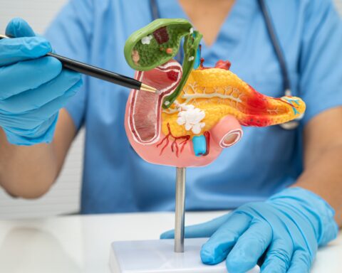 Pancreatic Cancer